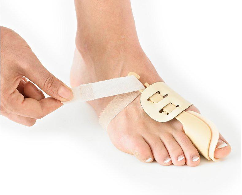 Bunion big toe night splint